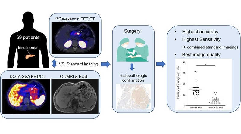 Image: PET/CT scans of a patient with suspected insulinoma and a cross-sectional view of the torso (Photo courtesy of J. Nucl. Med.; doi.org/10.2967/jnumed.124.268158)