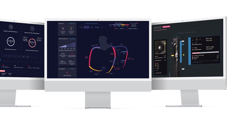 Image: Cleerly offers an AI-enabled CCTA solution for personalized, precise and measurable assessment of plaque, stenosis and ischemia (Photo courtesy of Cleerly)