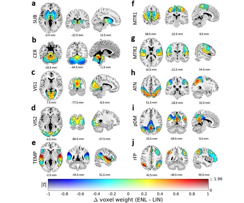 Image: The scans revealed a new dimension of brain network organization in humans (Photo courtesy of Georgia State University/TReNDS Center Research)