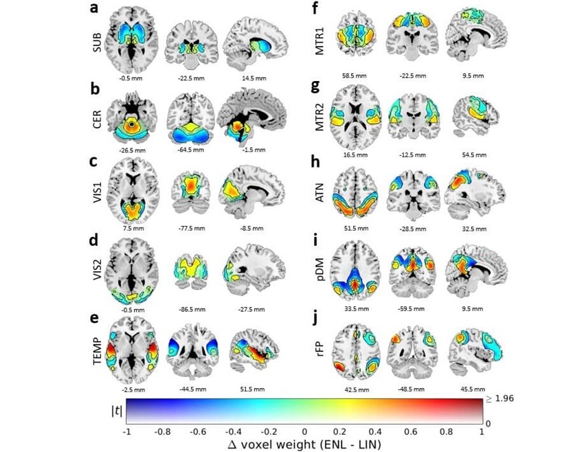 Image: The scans revealed a new dimension of brain network organization in humans (Photo courtesy of Georgia State University/TReNDS Center Research)