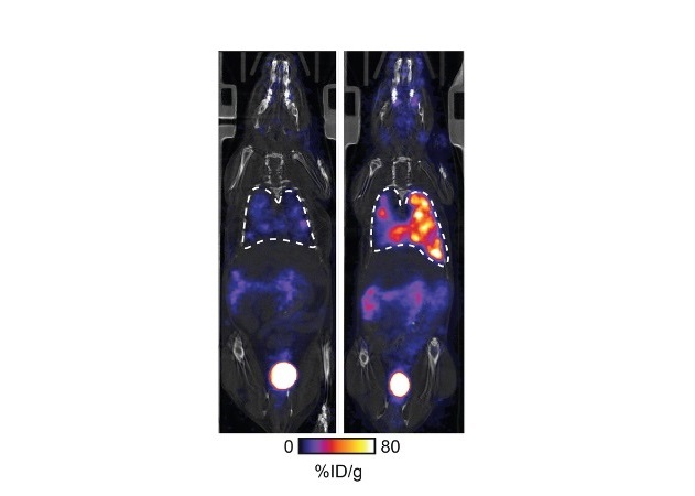 Image: The chemical compound lights up treatment-resistant cancers on imaging scans (Photo courtesy of King’s College London)