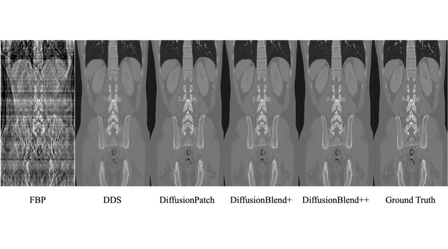 Image: The results of the eight-view 3D CT reconstruction from a public dataset (Photo courtesy of Medical Physics, doi.org/10.1002/mp.12345)