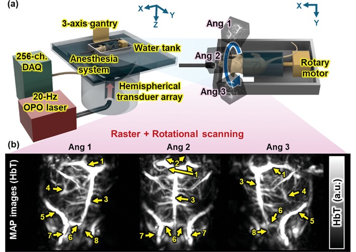 Image: Whole-brain PACT system and in vivo morphological imaging (Photo courtesy of Advanced Science)