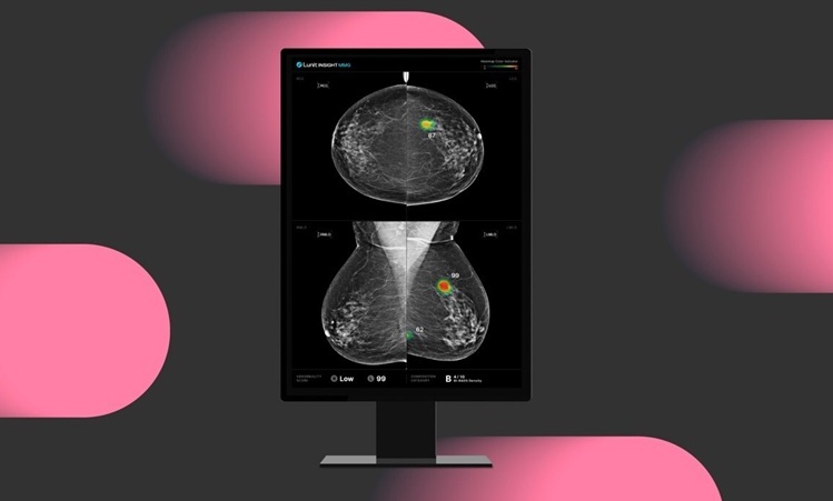 Image: The INSIGHT MMG AI-powered mammography analysis solution (Photo courtesy of Lunit)