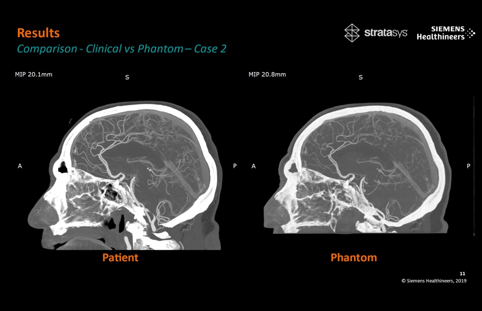 Image: The patient-specific 3D-printed phantoms usher in a new era for medical imaging research (Photo courtesy of Siemens Healthineers)