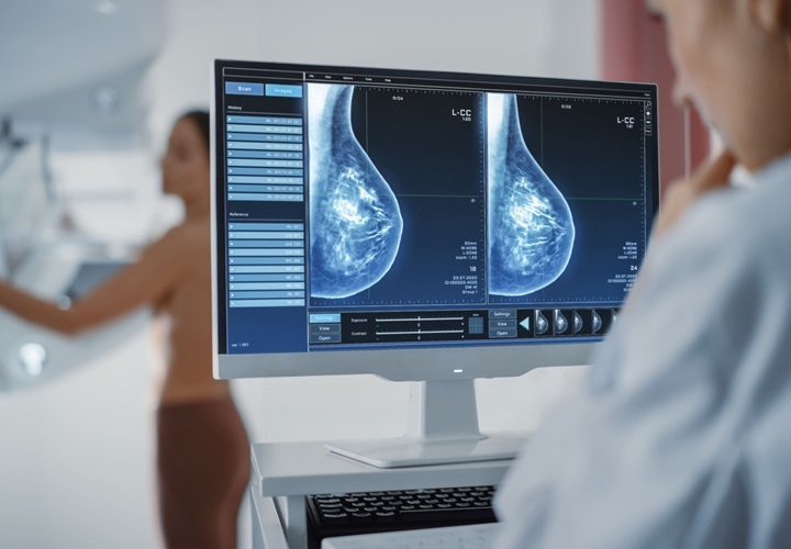 Image: The deep learning model predicts cardiovascular risk based on mammogram images (Photo courtesy of 123RF)