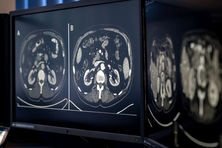 Image: CT scans are routinely taken during cancer treatment (Photo courtesy of Astrid Eckert/TUM)