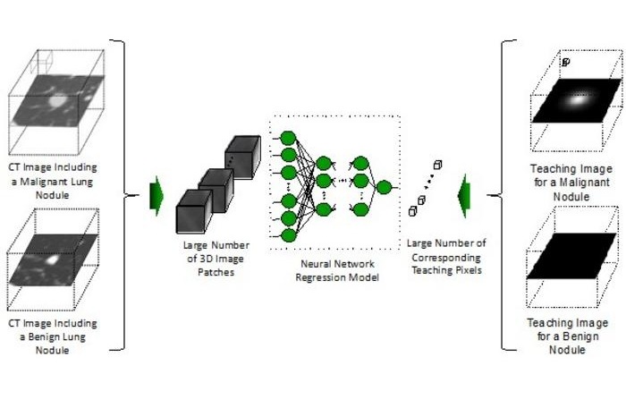 Image: Schematic representation of the ultra-lightweight AI model architecture and training process (Photo courtesy of Kenji Suzuki/Institute of Science Tokyo)