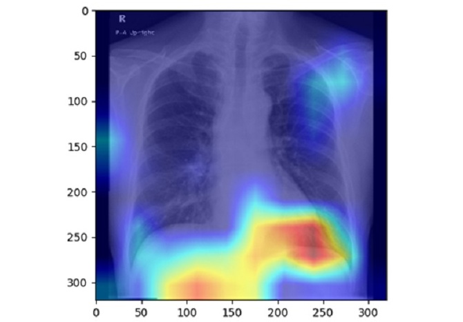 Image: AI decision-making process with chest X-ray images (Photo courtesy of Osaka Metropolitan University)