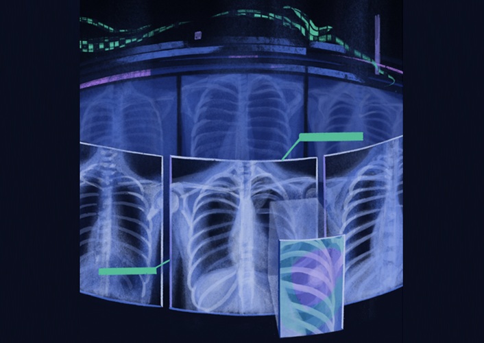 Image: The Ark+ tool can help doctors read chest X‑rays better and improve health care outcomes (Photo courtesy of V. Alrich and L. J. P. Liang/Arizona State University)