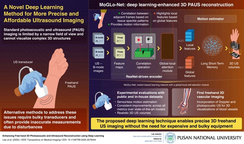 Image: MoGLo-Net tracks the motion of the ultrasound transducer using tissue speckle data without the need for external sensors (Photo courtesy of Pusan National University)