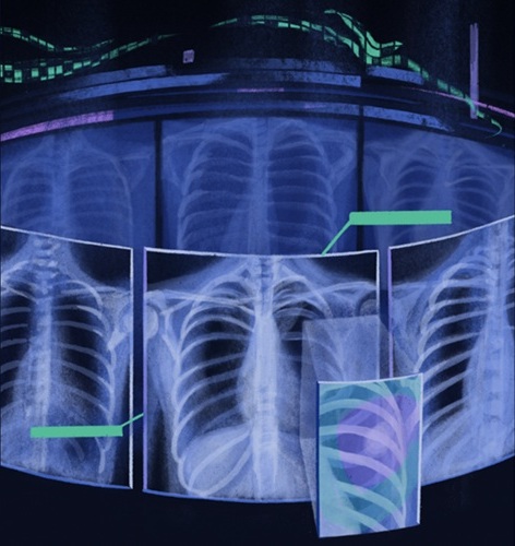 Image: The Ark+ tool can help doctors read chest X‑rays better and improve health care outcomes (Photo courtesy of V. Alrich and L. J. P. Liang/Arizona State University)
