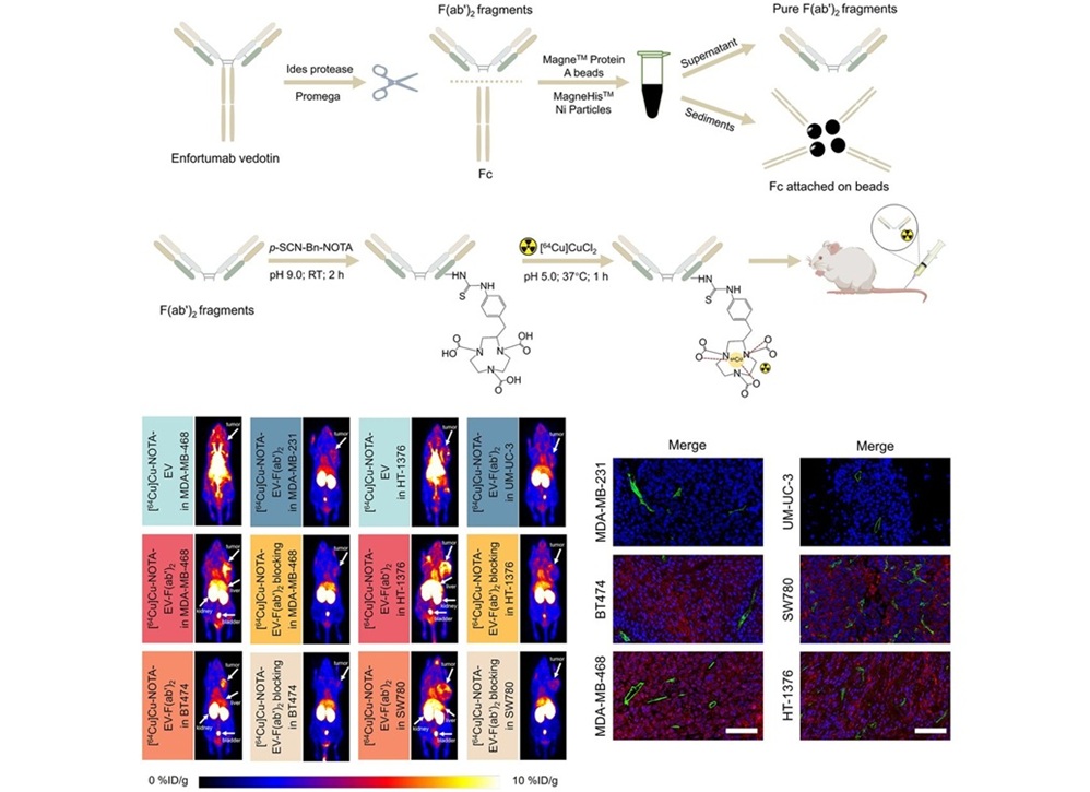 Image: The new tracer, 64Cu-NOTA-EV-F(ab′)2​, targets nectin-4, a protein strongly linked to tumor growth in both TNBC and UBC cancer types. (Wenpeng Huang et al., DOI: 10.2967/jnumed.125.270132)