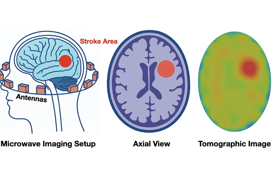 Image: Microwave-based imaging techniques like CT scanners can pinpoint tissue changes like a brain hemorrhage or stroke (Photo courtesy of NYU Tandon)