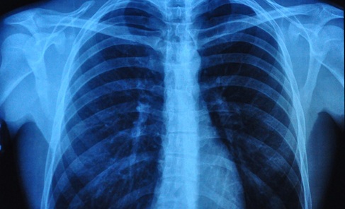 Image: The deep learning model detects subtle, age-related changes from chest X-rays (Photo courtesy of 123RF)