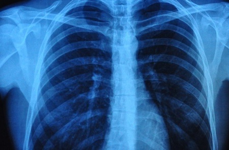 Image: The deep learning model detects subtle, age-related changes from chest X-rays (Photo courtesy of 123RF)