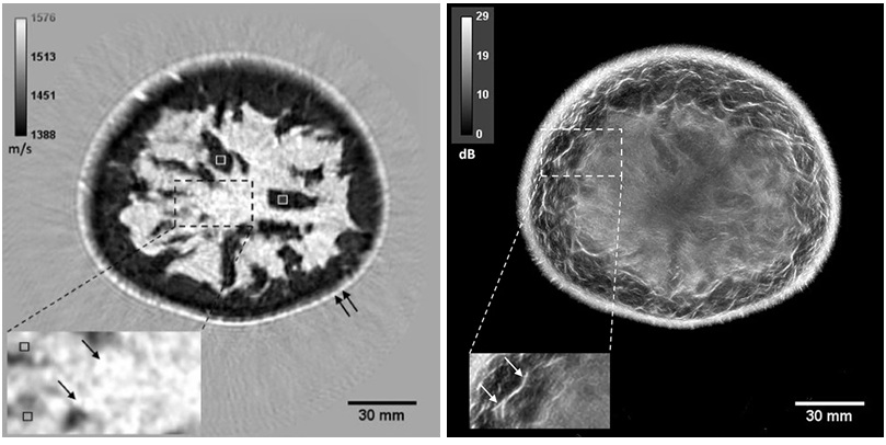 Image: QT Imaging’s latest breast imaging software adds enhanced reflection images by combining speed-of-sound and reflection data (photo courtesy of QT Imaging)