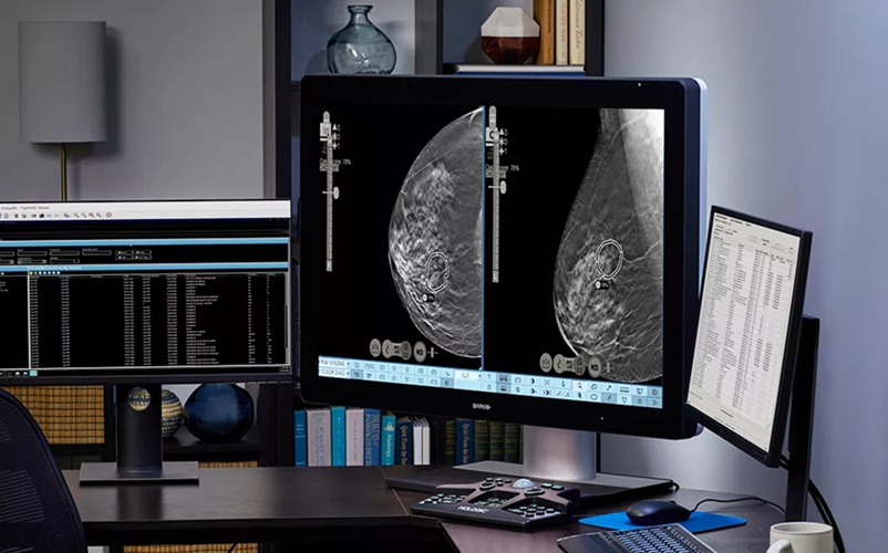 Image: The Genius AI Detection solution identifies likely breast cancer lesions and highlights suspicious areas at radiologists’ workstations to support interpretation (photo courtesy of Hologic)