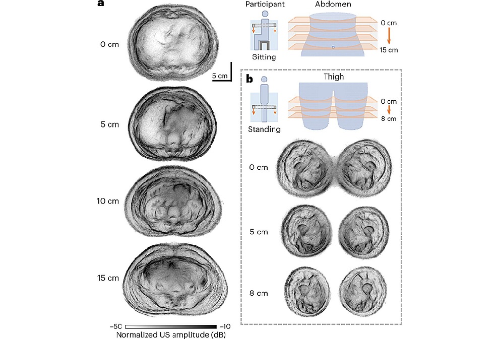 Image: Whole cross-sectional UST of a healthy adult female (participant 1) (Garrett, D.C., Xu, J., Oh, D. et al. Nat. Biomed. Eng (2026). https://doi.org/10.1038/s41551-026-01660-4)