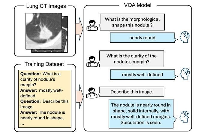 Image: Researchers develop a vision-language model trained on large-scale data to generate clinically relevant findings from chest computed tomography images through visual question answering (Ms. Maiko Nagao from Meijo University, Japan)