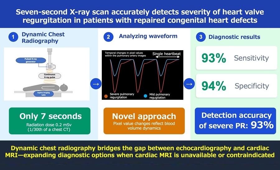Image: Kyushu University researchers use Dynamic Chest Radiography (DCR) to evaluate the severity of Pulmonary Regurgitation (PR), a common complication after treatment of the congenital heart disease Tetralogy of Fallot. The analysis only requires the patient to hold their breath for seven seconds for a sequence of images of their heart to be taken. The images are then analyzed and extracted into a waveform that can show the severity of PR. The new technique\\\'s detection accuracy of severe PR is 93%, with a sensitivity of 93% and a specificity of 94%. (Photo courtesty of Kyushu University/Yuzo Yamasaki)