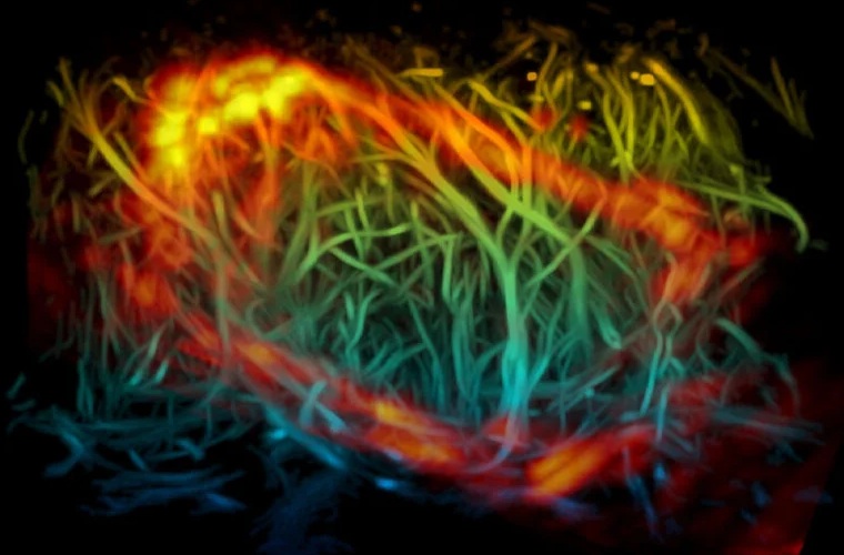 Image: A cross-section through the brain reveals the symmetric architecture of the vascular network (cyan-green) and the tracer highlighting the glymphatic system (red-yellow) along the brain\'s surface and drainage routes—imaged through the intact skull with 3D-PAULM. (Photo courtesy of Duke University)