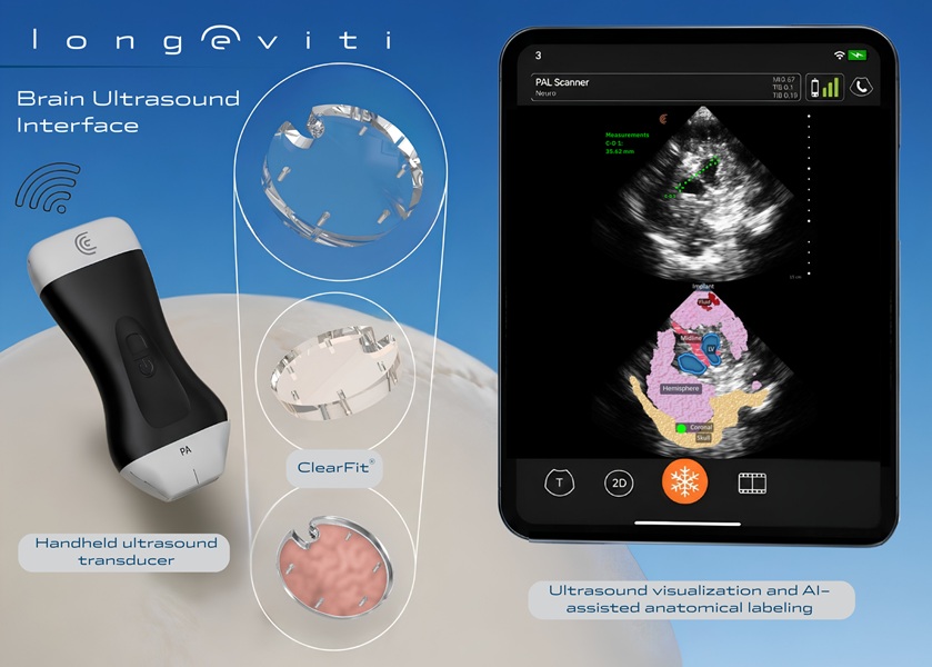 Image: ClearFit AI, a Brain Ultrasound Interface (BUI). (Photo courtesy of Longeviti Neuro Solutions) Image: ClearFit AI, a Brain Ultrasound Interface (BUI). (Photo courtesy of Longeviti Neuro Solutions)