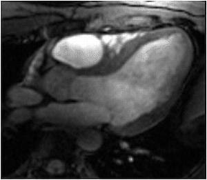 Image: Magnetic resonance image (MRI) of a beating heart (Photo courtesy of the Berlin Ultrahigh Field Facility / Charité-Universitätsmedizin Berlin).