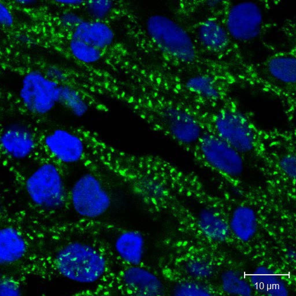 Image: Human heart muscle cells growing in the 3D tissue structure. The cells have been stained with fluorescent molecules to identify the nuclei (blue) and cardiac-specific protein (green) (Photo courtesy of IBN at A*STAR). Image: Human heart muscle cells growing in the 3D tissue structure. The cells have been stained with fluorescent molecules to identify the nuclei (blue) and cardiac-specific protein (green) (Photo courtesy of IBN at A*STAR).