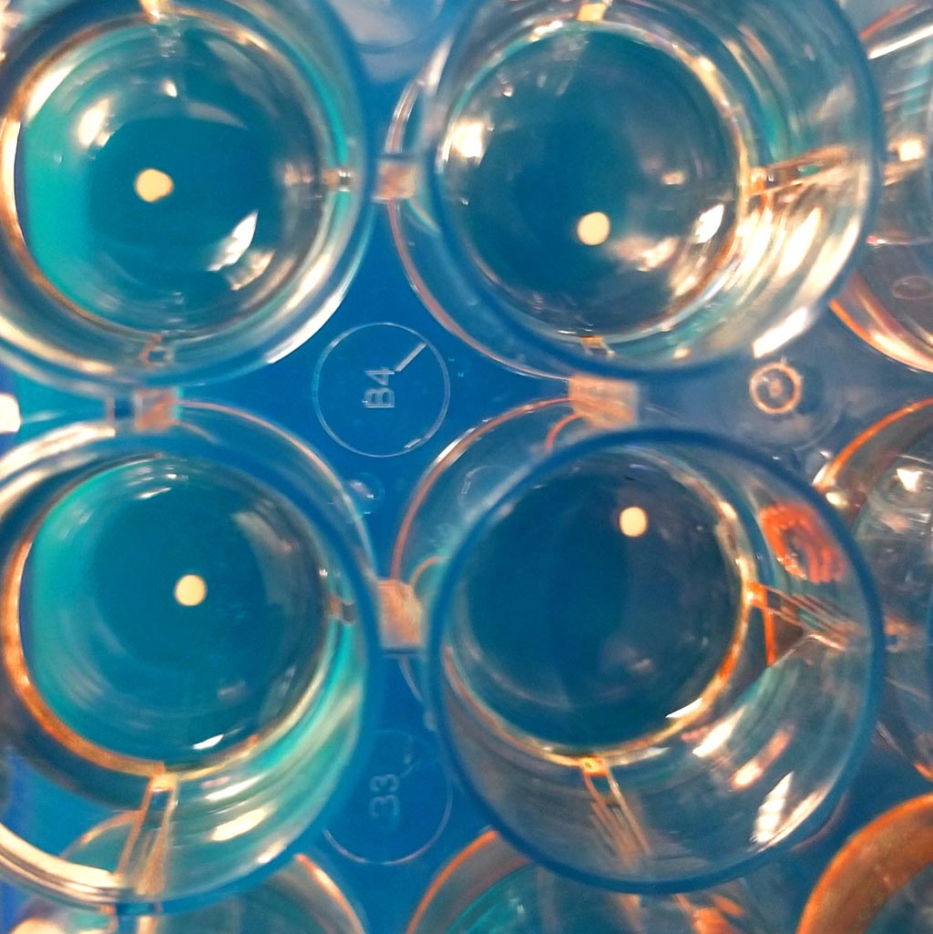 Image: Microcultures of oligocortical spheroids (Photo courtesy of Case Western Reserve University School of Medicine). Image: Microcultures of oligocortical spheroids (Photo courtesy of Case Western Reserve University School of Medicine).