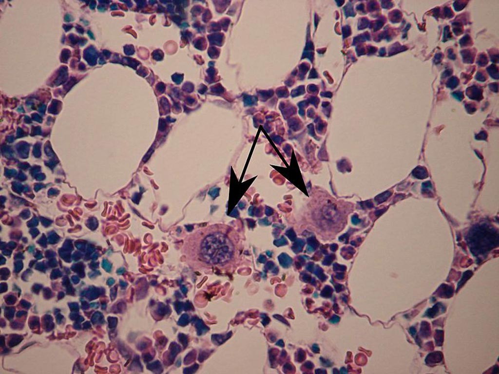 Image: Two megakaryoctes (see arrows) are visible in this slide of bone marrow (Photo courtesy of Wikimedia Commons). Image: Two megakaryoctes (see arrows) are visible in this slide of bone marrow (Photo courtesy of Wikimedia Commons).