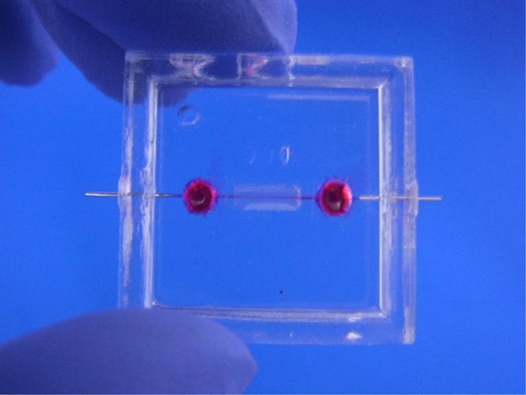 Image: The microvessel-on-a-chip used for angiogenesis research (Photo courtesy of Dr. Yukiko Matsunaga, Institute of Industrial Science, the University of Tokyo). Image: The microvessel-on-a-chip used for angiogenesis research (Photo courtesy of Dr. Yukiko Matsunaga, Institute of Industrial Science, the University of Tokyo).
