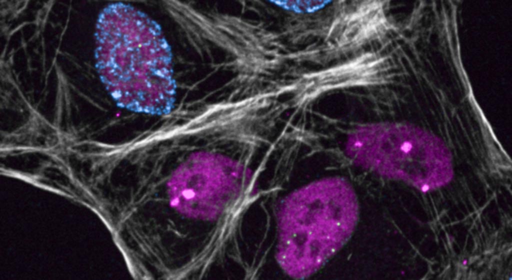 Image: Specialized proteins protect damaged DNA in the cell nucleus (pink shapes) until the damage can be repaired (Photo courtesy of the University of Copenhagen). Image: Specialized proteins protect damaged DNA in the cell nucleus (pink shapes) until the damage can be repaired (Photo courtesy of the University of Copenhagen).