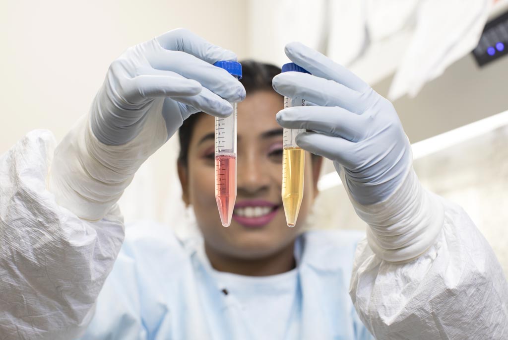 图片:TZA检验中,Anwesha Sanyal博士指出感染HIV的细胞聚集在试管底部。黄色表示被激发的(图片蒙匹兹堡大学惠赐)。 图片:TZA检验中,Anwesha Sanyal博士指出感染HIV的细胞聚集在试管底部。黄色表示被激发的(图片蒙匹兹堡大学惠赐)。