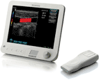 Wireless Ultrasound