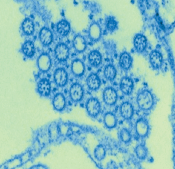 Imagen: Microfotografía electrónica de barrido (SEM), mostrando el virus 2009 H1N1 (Fotografía cortesía del CDC – Centros para el Control y Prevención de las Enfermedades de los Estados Unidos).