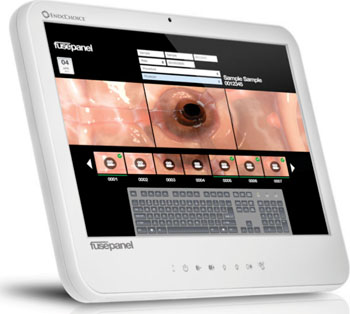 Imagen: El panel de control del sistema EndoCoice Fuse (Fotografía cortesía de Endochoice).