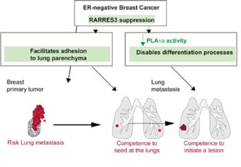 Imagen: Gráfico que explica las consecuencias de la pérdida de la función de RARRES3 para la metástasis de cáncer de mama en el pulmón (Fotografía cortesía del Instituto de Investigación en Biomedicina).