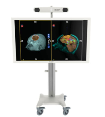 Imagen: La Guía BrightMatter, diseñada para seguir el camino de las herramientas múltiples durante un procedimiento quirúrgico en el cerebro (Fotografía cortesía de Synaptive Médica). Imagen: La Guía BrightMatter, diseñada para seguir el camino de las herramientas múltiples durante un procedimiento quirúrgico en el cerebro (Fotografía cortesía de Synaptive Médica).