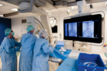Imagen: El software VesselNavigator, diseñado para el tratamiento de la enfermedad vascular (Fotografía cortesía de Philips Healthcare). Imagen: El software VesselNavigator, diseñado para el tratamiento de la enfermedad vascular (Fotografía cortesía de Philips Healthcare).