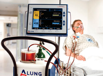 Imagen: El Sistema de Asistencia Respiratoria (RAS), Hemolung (Fotografía cortesía de ALung Technologies).