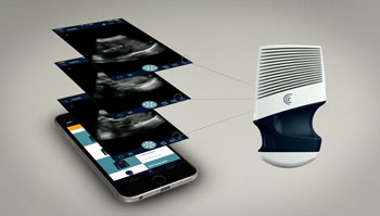 Imagen: El escáner portátil Clarius para ultrasonido (Fotografía cortesía de Clarius Mobile Health). Imagen: El escáner portátil Clarius para ultrasonido (Fotografía cortesía de Clarius Mobile Health).