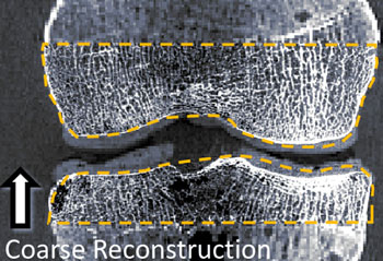 Imagen: La reconstrucción con imágenes de una articulación utilizando CBCT/CMOS (Fotografía cortesía de la Universidad Johns Hopkins). Imagen: La reconstrucción con imágenes de una articulación utilizando CBCT/CMOS (Fotografía cortesía de la Universidad Johns Hopkins).