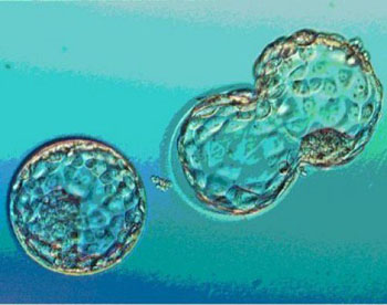 Imagen: Un embrión en un medio de cultivo (Fotografía cortesía de ivf.com).