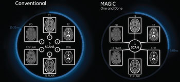 Imagen: Una comparación de la RM convencional y la MAGiC (Fotografía cortesía de GE Healthcare).