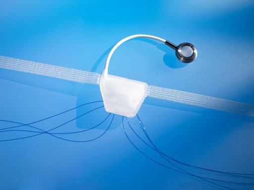 Transobturador ajustable trata la incontinencia masculina - Tecnicas  Quirurgicas - mobile.