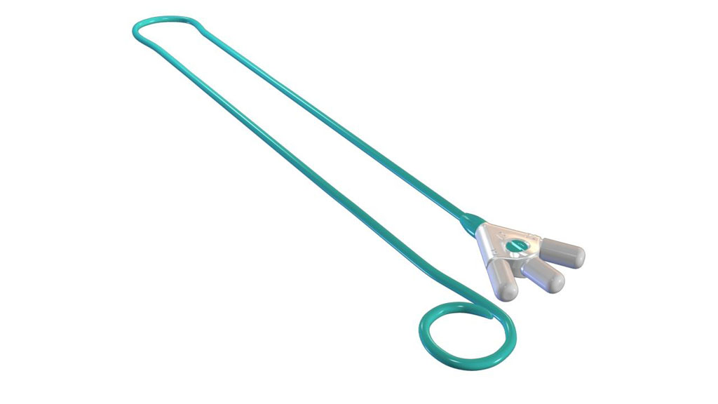 Imagen: El stent nefroureteral ConvertX mantiene el uréter permeable (Fotografía cortesía de BrightWater Medical).