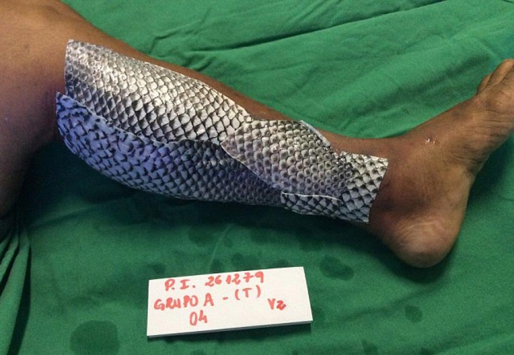 Imagen: Las pieles de pescado podrán servir pronto como vendajes para quemaduras (Fotografía cortesía de la Agencia de Noticias Caters).
