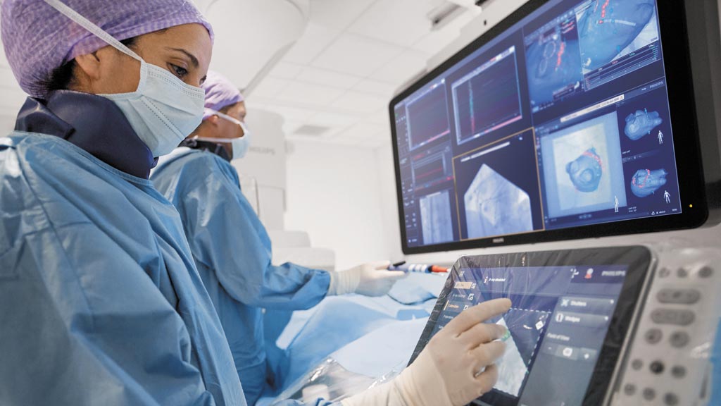 Imagen: La plataforma de terapia cardiológica guiada por imágenes Azurion (Fotografía cortesía de Philips Healthcare).