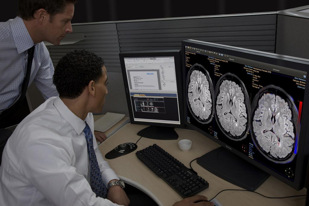 Imagen: La Imagenología Cerebral Longitudinal (LoBI) es y la última aplicación clínica del portal IntelliSpace 9.0 aprobada para distribución en los Estados Unidos (Fotografía cortesía de Philips Healthcare). Imagen: La Imagenología Cerebral Longitudinal (LoBI) es y la última aplicación clínica del portal IntelliSpace 9.0 aprobada para distribución en los Estados Unidos (Fotografía cortesía de Philips Healthcare).